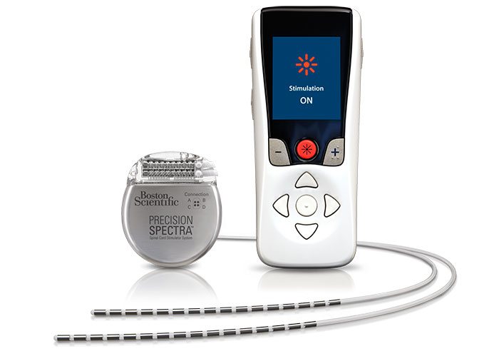 Senza Spinal Cord Stimulation System – P130022/S039